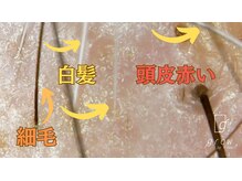 頭皮ケア専門サロン グロウ(grow by k-two)/頭皮お悩みありませんか？