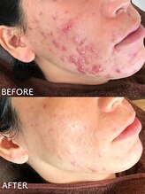 ビアンカ/お客様のお声