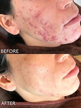 ビアンカ/お客様のお声