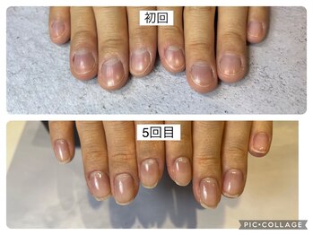 アンドネイル 海老名(&nail)/5回で美爪！