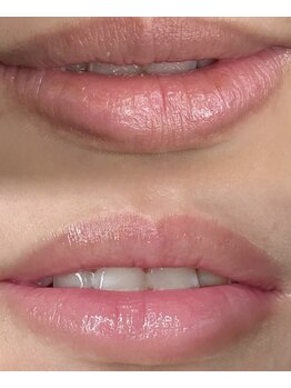 フェリス(feliz)/ローマピンク[エステサロン]