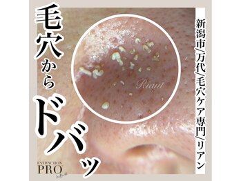 リアン(Riant)/毛穴ケアコース