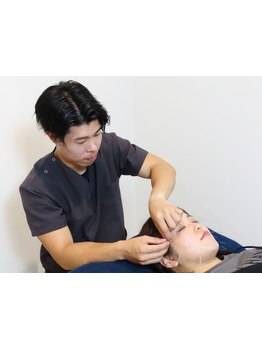 鍼灸施術を受けたい