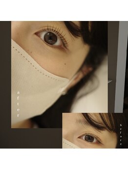 キルナノール 福岡天神(kiruna norr)/くるんとカール