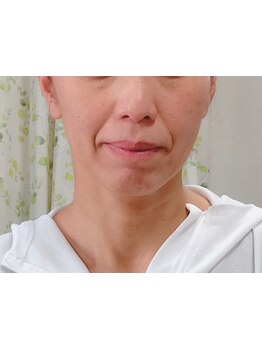 お肌をきれいにしたい