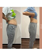 和ぎ整体院/腹直筋離開改善