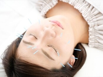 七草はり灸マッサージ院の写真/美容鍼で顔のコリを撃退!肌質改善やリフトアップも狙います。