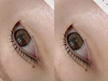 アイビューティー ロキエ 天王寺店(ROCHIE)/黄金比美眉デザイニング間引き