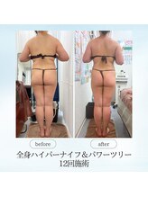 エスプレッソ(espresso,)/【肩こり】ツリーで疲労スッキリ