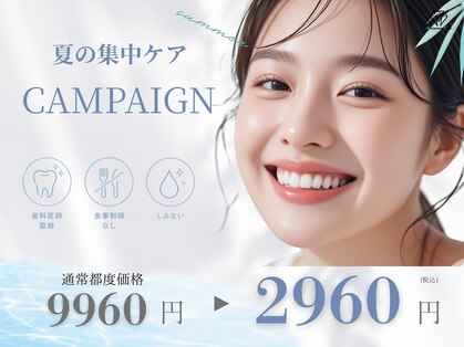 歯のホワイトニング 岐阜アクティブG店の写真