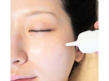 アズ(AZU)の雰囲気（ポイントシミケア。新機種導入！9月末までリピーター様限定です）