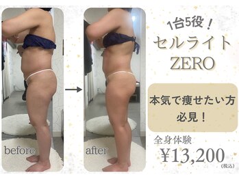 ナチュールファースト(naturel first)の写真/【スタッフおすすめ！！】夏に向けてのボディケア★　1回でも変化実感◎全身スッキリ痩身コース
