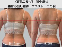 ジェイオー(J.O)の雰囲気（コルギの技で背中の脇肉、巻肩、ウエストもむくみゼロすっきりへ）