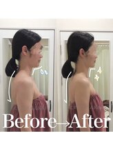 えすてさろん ケイアンドエフ(k&f)/【デコルテ】姿勢・凝りもケア