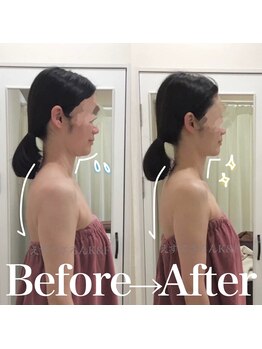 えすてさろん ケイアンドエフ(k&f)/【デコルテ】姿勢・凝りも整う