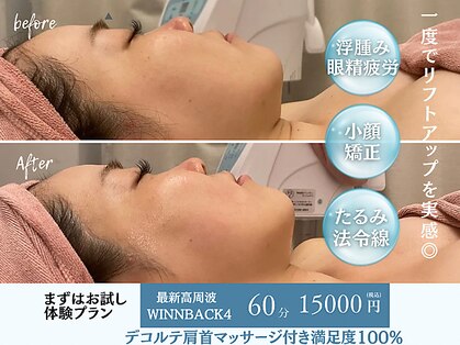 イリゼ(iriser)の写真