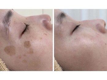 アップル 宇都宮店(Apple.)/最優秀賞受賞！