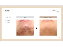 アロマビューティーサロン ジェイハウス(J)/