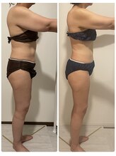 サルサナ(Salu Sana)/お腹の厚みがスッキリ！