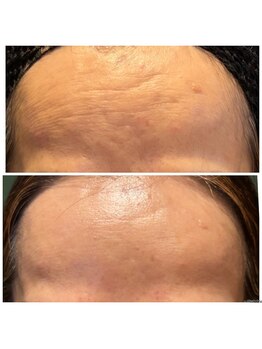 オルオル(Olu'olu)/レッドショット×エステダーマ