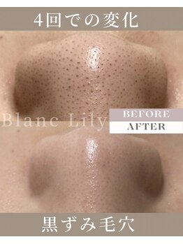 ブランリリー(Blanc Lily)の写真/薬院大通駅から徒歩4分の落ち着くサロン♪上質なエステタイムで、毛穴レスな美肌を手に入れてみませんか？