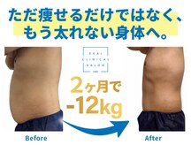 ジール(ZEAL)