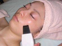 癒しの整体 アペーゼ/超音波洗浄　ピーリング