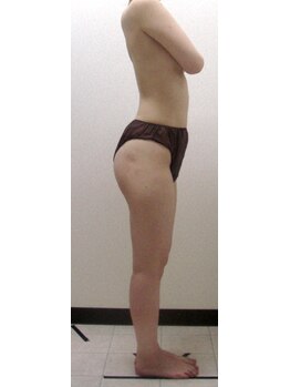 ジョイア 本店(Beauty＆Detox gioia)/安曇野市20代のお客様アフター