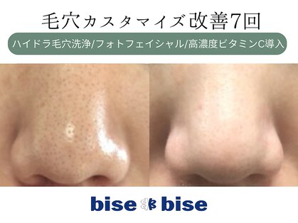 ビズビズ 天王寺店(bisebise)の写真