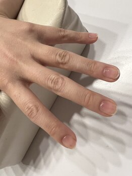 ナチュラドール(NATURADORm)の写真/深爪等の爪のトラブルに悩んでいる方必見！丁寧な施術と知識でどんな状態の爪も美しい状態へ♪