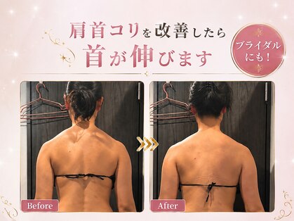 一花の写真