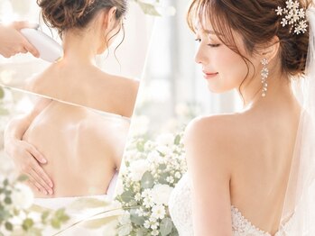 アンベリール カマクラ(embellir KAMAKURA)の写真/結婚式やイベント前の大切な日に◎「うなじ＋背中脱毛」でドレス姿を格上げ！自信の持てる後ろ姿