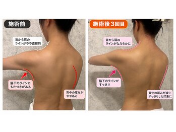 ドクタースタイル(Dr.style)/【施術3回の変化】