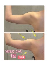 エクセレントビューティーサロン 艶(EN)/ブライダル１回