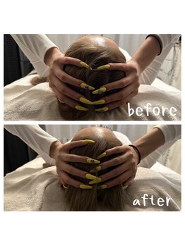 ルビー 新宿(Ruby)/頭から小顔に