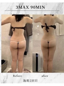 ラズリ(Lazuli)/3max 90min 施術2回