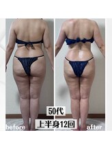 グラチア(Gratiae)/