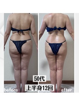 グラチア(Gratiae)/