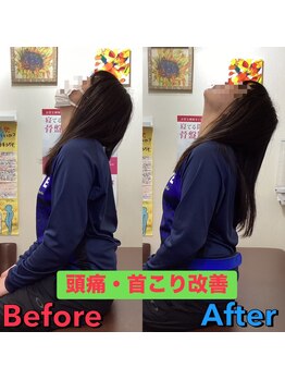 ヒデ整体院(Hide整体院)/猫背矯正骨盤矯正B/A肩こり腰痛