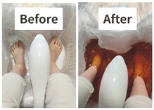 スマイルエム(SmileM)