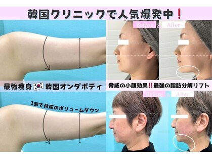 カンナムビューティー 福岡天神店の写真
