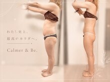 カルマーアンドビー(Calmer & Be.)の雰囲気（Wキャビテーションでの、結果出し痩身もありますよ☆）