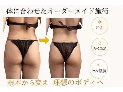 タノソイネ(tanosoine)の写真
