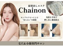 シェノン(Chainon)