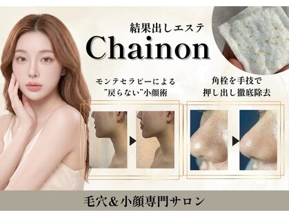 シェノン(Chainon)の写真