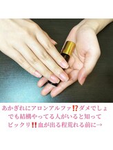 桃の木 吉祥寺店/あかぎれにアロンアルファ!?