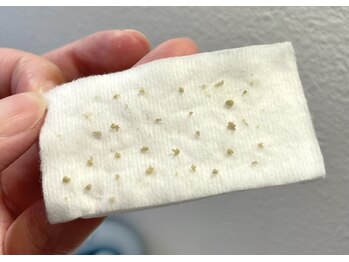 ウェクシー(WECXII)/毛穴に詰まった角栓