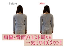 小顔製作所 心斎橋院/肩幅矯正　施術実例２