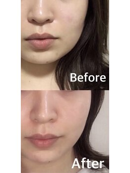 サロン ド プリヴェ(Salon de PRIVE)/浮腫み&たるみケアで変わる!