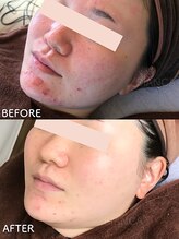 ビアンカ/赤みケア/ハリつやアップ/美白